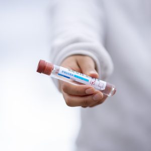 Test Tube for laboritory Blood test